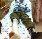  يافا: إصابة متوسطة للحاج زكي خيمل "أبو عيسى" بحادث دهس "ضرب وهرب"